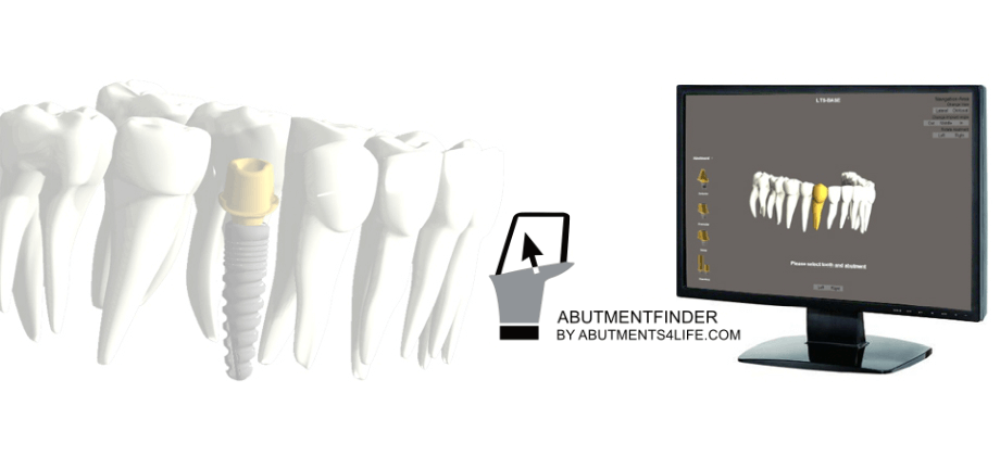 Entdecken Sie unseren interaktiven Abutmentfinder LTS-Abutmentfinder